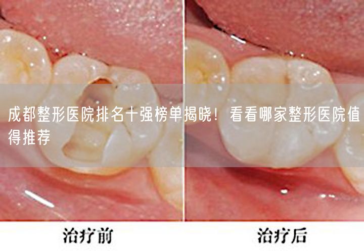 成都整形医院排名十强榜单揭晓！看看哪家整形医院值得推荐