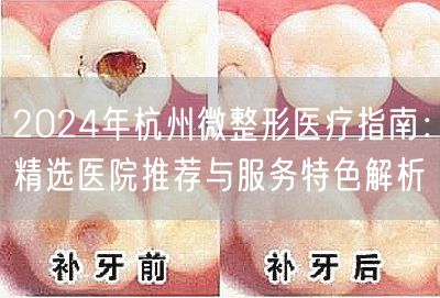 2024年杭州微整形医疗指南：精选医院推荐与服务特色解析