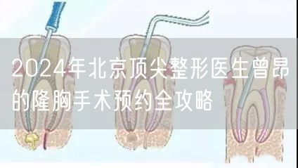 2024年北京顶尖整形医生曾昂的隆胸手术预约全攻略