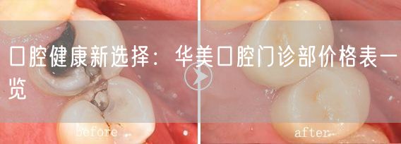 口腔健康新选择：华美口腔门诊部价格表一览