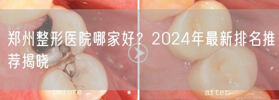 郑州整形医院哪家好？2024年最新排名推荐揭晓
