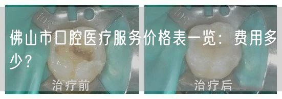 佛山市口腔医疗服务价格表一览：费用多少？