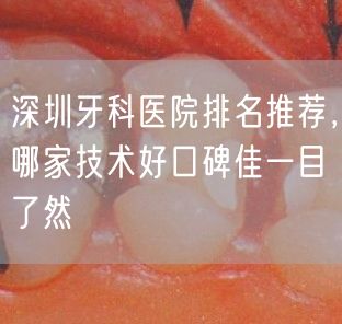深圳牙科医院排名推荐，哪家技术好口碑佳一目了然