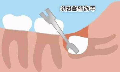 2024年西安口腔医疗服务指南：十佳口腔医院推荐(图1)