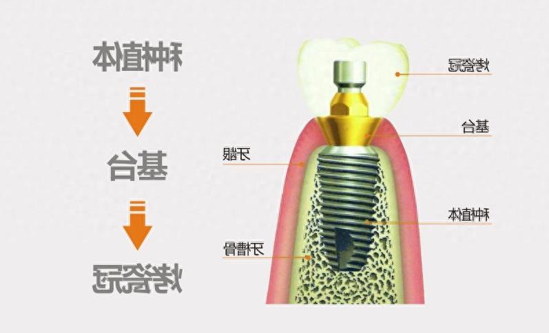2024年广州牙齿修复价格全解析：医院选择与性价比评估(图1)