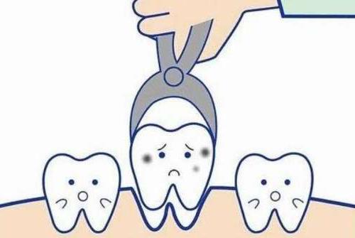 德国威兰德全瓷牙是什么？它对健康有好处吗？(图3)