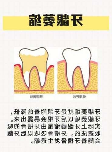 儿童涂氟的最佳年龄是几岁？另外，能告诉我一般的价格吗？(图2)