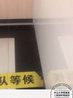 中山大学附属第三医院岭南医院鼻部专家介绍，2025价目表曝光~ 曼特波假体隆鼻18182起(图1)