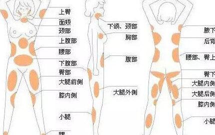 做抽脂手术大概多少钱呢？操作抽脂手术的过程是什么样的？(图1)