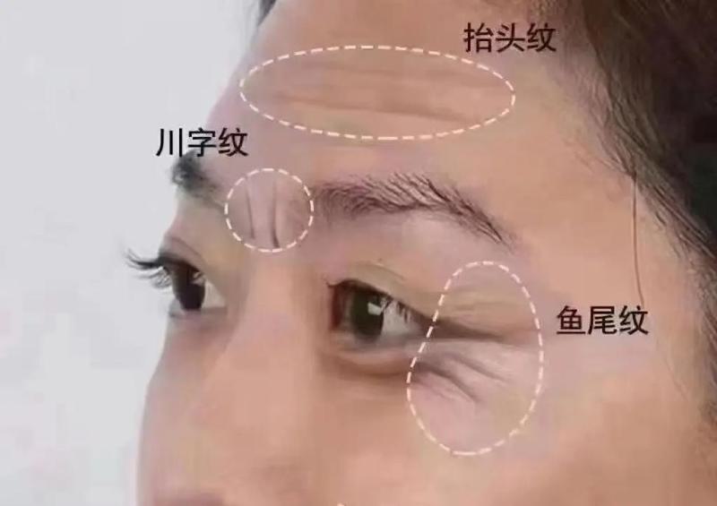 武夷山丽姿医疗美容医院优惠活动多吗？确实丰富且实惠，值得关注！(图1)