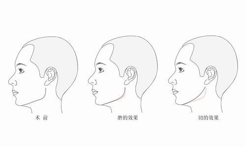 镇江江滨医院整形美容科怎么样？内含价格表及案例分析