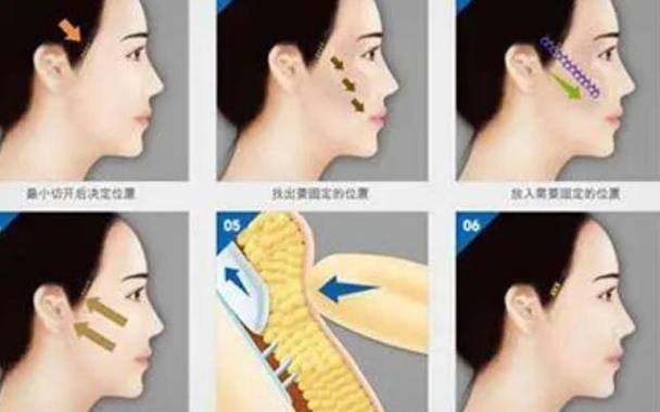 成都熙美本色跟娇点哪个好，实力对比看看哪家更强？