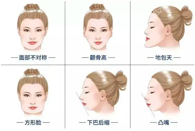 重庆磨骨较好的医生，肖林、王涛、李伟谁的技术好些？医生详细信息
