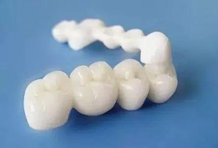威兰德全瓷牙1600元是真的吗？全瓷牙使用注意事项要知道