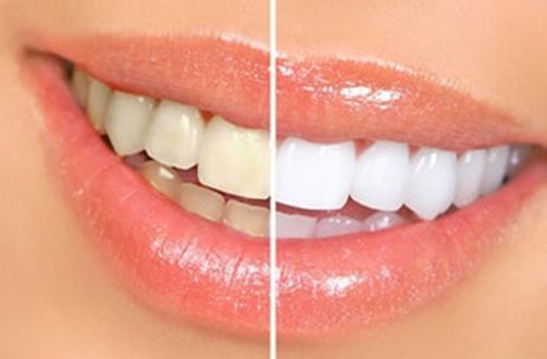 安泰口腔怎么样？是私立，但正规靠谱技术扎实(图1)