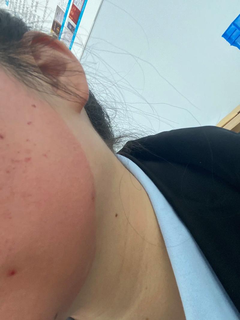 成都素美医疗整形医院怎么样？医生技术、热门项目、客户口碑！