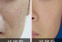 成都米兰柏羽整形医院怎么样？做整形贵不贵？附项目案