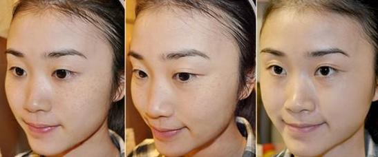 成都出彩医美怎么样？看医院介绍和热门项目知技术口碑都挺好！