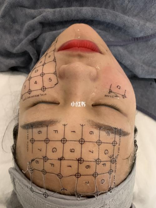热玛吉四代和五代的区别_哪个更适合你？为你揭秘！
