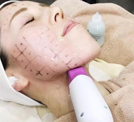 40岁做线雕还是热玛吉效果更好_两者有什么区别，选择哪个更好？