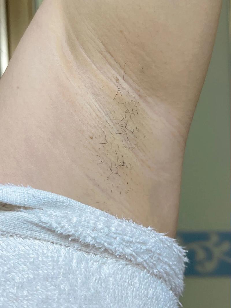 成都八大处美容私密整形怎么样？成都八大处美容私密整形费用？(图1)