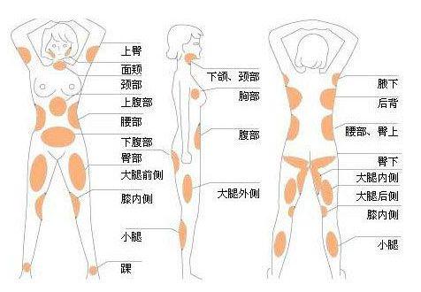 广州美咖整形医院怎么样？含有医生资料~案例分享！