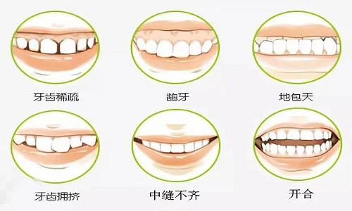 柯桥博雅口腔医院的徐晓锋医生口碑如何？技术精湛且荣获多项荣誉(图1)