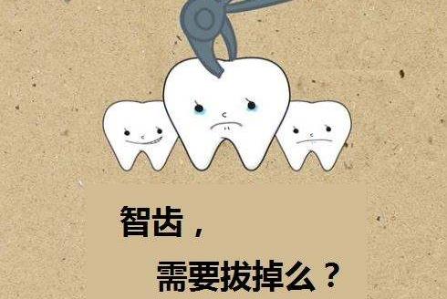 嵌体补牙后悔一辈子怎么样？嵌体补牙能用多长时间(图1)
