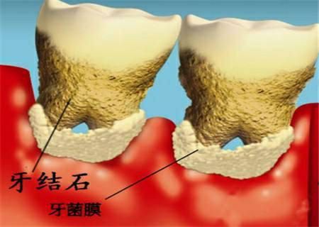 苏州附二医院口腔科技术怎么样？拥有29台芬兰牙椅和2台瑞典种植机，口碑评价如何