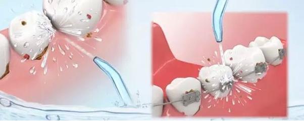 安阳值得口腔怎么样？特色项目+价格表