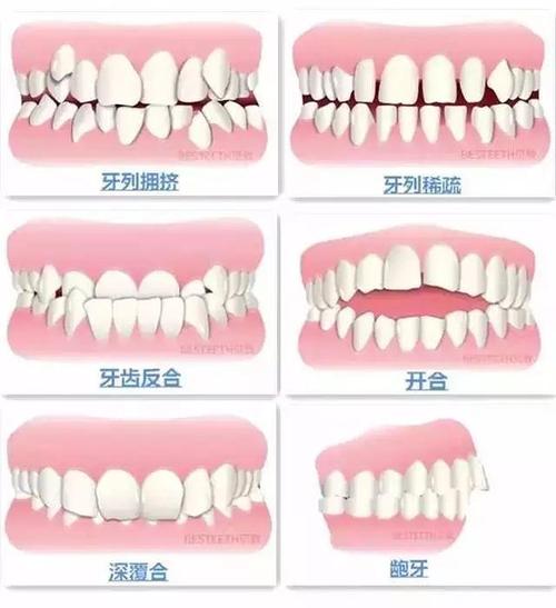 京一口腔收费标准大揭秘：价目表一览，洗牙、拔牙等费用多少？价格贵吗？