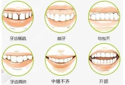 牙齿矫正最佳年龄段是什么时候？内含价格表及案例分析(图1)