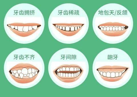乐山口腔医院怎么样？做牙齿矫正好不好？附案例和价格表！