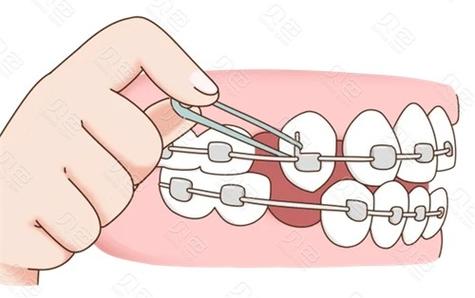 广大口腔医院是正规医院吗？种牙、正畸、修复都很棒的医院！