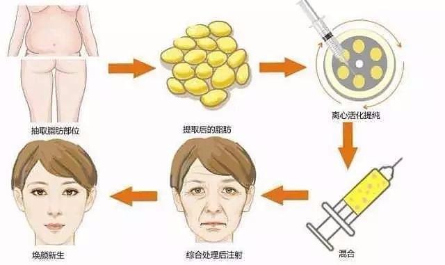 宁波珈禾整形医院怎么样？是正规医院医生技术过硬，口碑好！