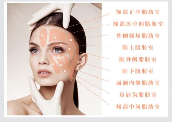 成都素美做自体脂肪填充怎么样？附案例及价格表