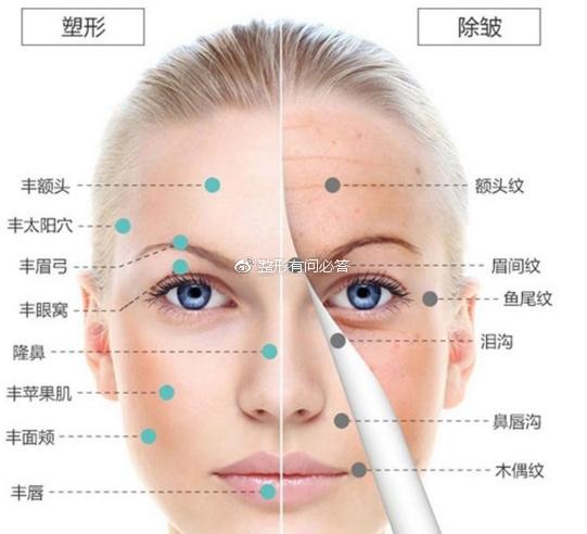 杭州盛美嘉合整形医院正规吗？点击查看医生名单和价格