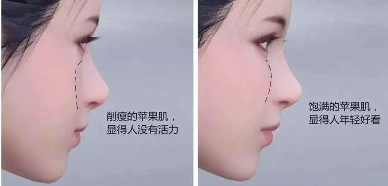 成都较好的整形医院排名较好是哪家？成都较好的整形医院排名前五介绍！