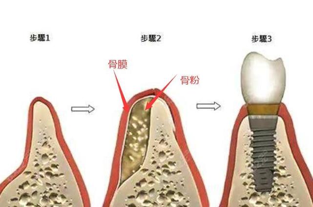 洁雅口腔医院怎么样？口碑好不好？(图1)