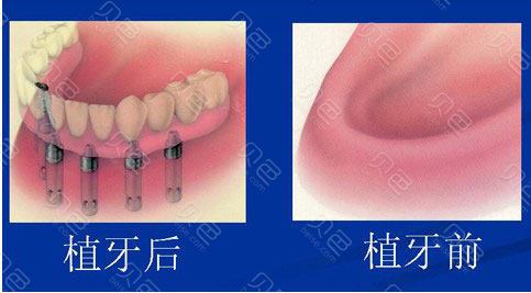 中诺口腔医院是正规的吗？内附有医院的信息和特色项目介绍！