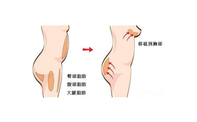 广州韩妃整形医院美容实力如何？广州韩妃医生技术好吗？整形案例！